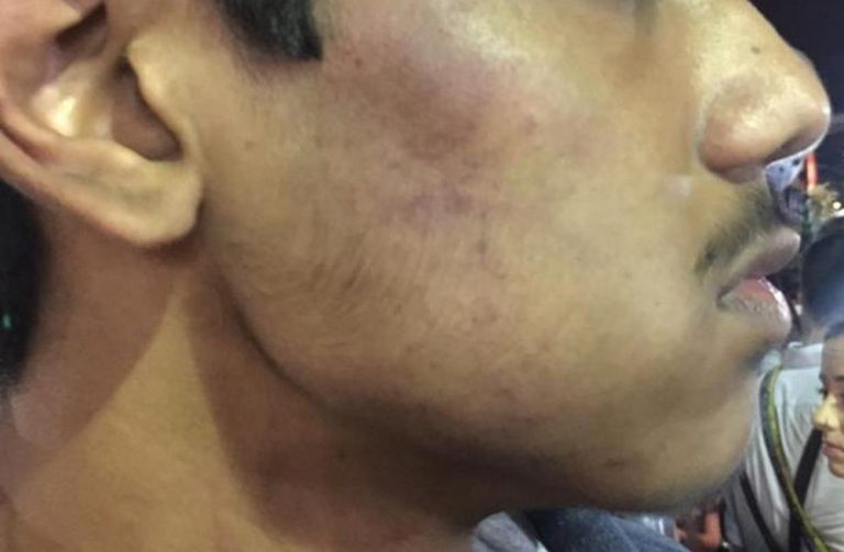 Estudante indiano de 16 anos é confundido com suspeito de furto e sofre agressão na Oktoberfest em SC