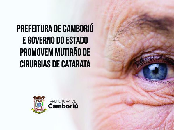 Mutirão de cirurgias de catarata será de 7 a 9 de novembro
