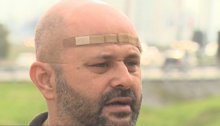 Homem vende moto para comprar e doar antenas que cortam linha com cerol