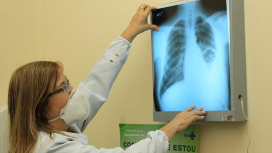 Casos de síndrome respiratória aguda grave diminuem, diz Fiocruz