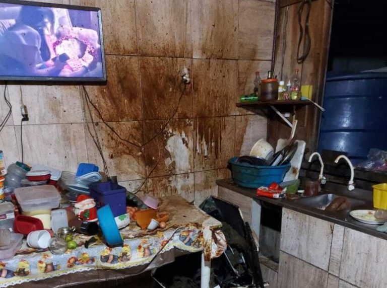 Panela de pressão explode e mulher sofre queimaduras no rosto e braço