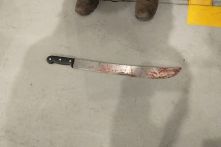 Após tentar matar desafeto e arma falhar, homem tem mãos decepadas com facão no Monte Alegre