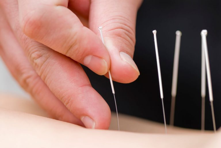 Empresaria tem pulmão perfurado durante sessão de acupuntura