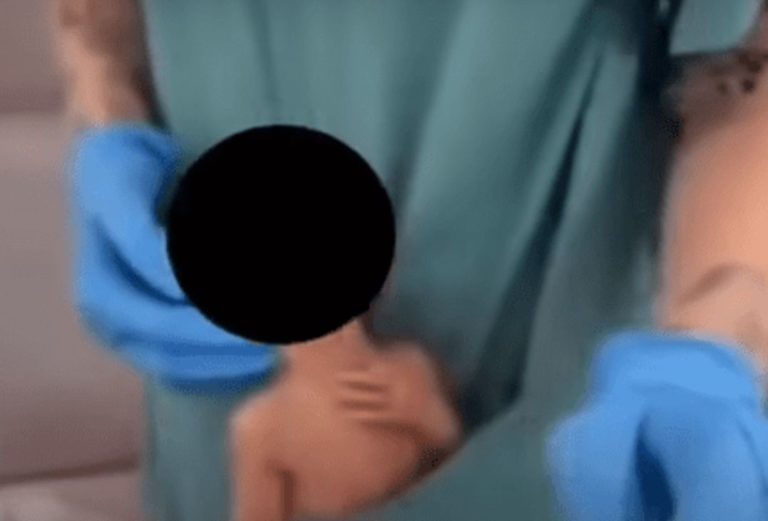 Bebê que foi filmado dentro de jaleco de funcionária é prematuro e continua internado